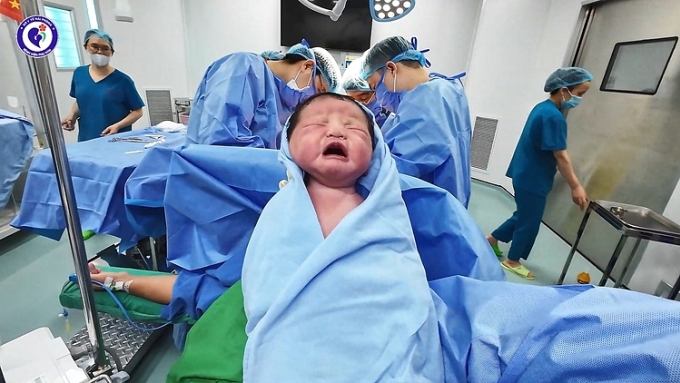 508620894-1167421792095807-187-7990-5833-1750237972 Em bé chào đời khỏe mạnh tại viện, Ảnh: Bệnh viện cung cấp