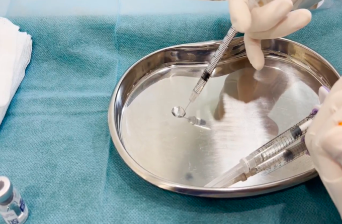 anh-chup-man-hinh-2025-06-12-l-8403-3423-1749721723 Bác sĩ thử chất lượng filler. Ảnh: Bác sĩ cung cấp