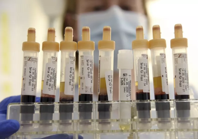 blood-jpg-1750643397-175064344-8249-4792-1750643503 Các ống huyết thanh chứa mẫu máu của bệnh nhân được xử lý tại phòng Phòng khám St. Georg ở Leipzig. Ảnh: DPA
