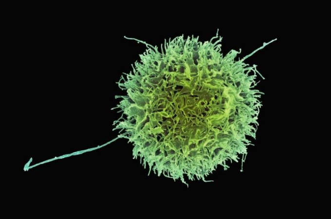 nk-cell-1750221288-7411-1750221353 Tế bào sát thủ trong cơ thể. Ảnh: Unplash