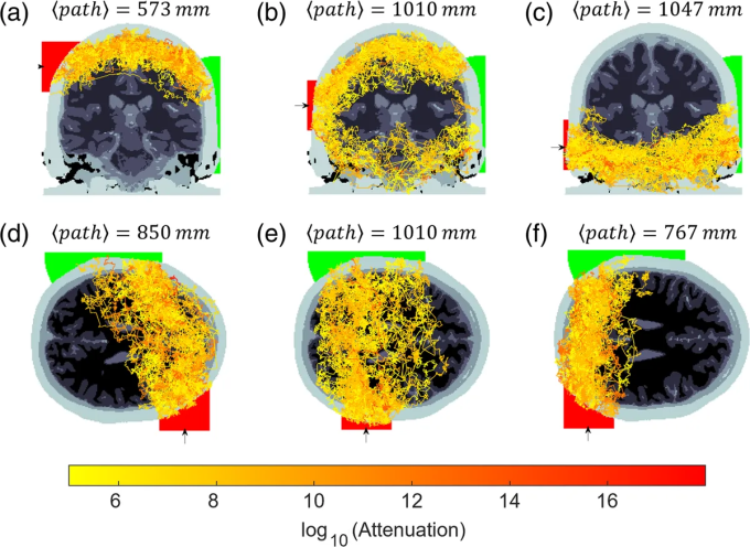 photon-transport-simulations-l-5990-5839-1750739229 Mô phỏng các đường đi của photon trong não bộ. Ảnh: Neurophotonics
