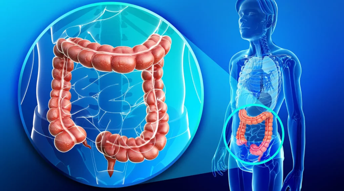 the-cancer-centre-colorectal-c-9477-4857-1751126385 Ung thư ruột đang trẻ hóa tại nhiều quốc gia trên thế giới. Ảnh: Cancer Centre