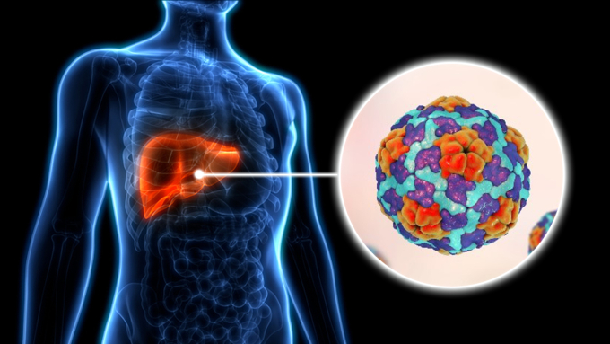 what-is-hepatitis-a-thumbnail-9032-8856-1749721924 Minh họa người có virus viêm gan A. Ảnh: CDC