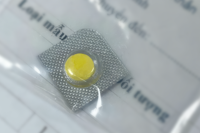 1-1751682391-8935-1751682584 Viên thuốc còn nguyên vỏ được gắp ra khỏi thực quản chị Hiếu. Ảnh: Bệnh viện Đa khoa Tâm Anh