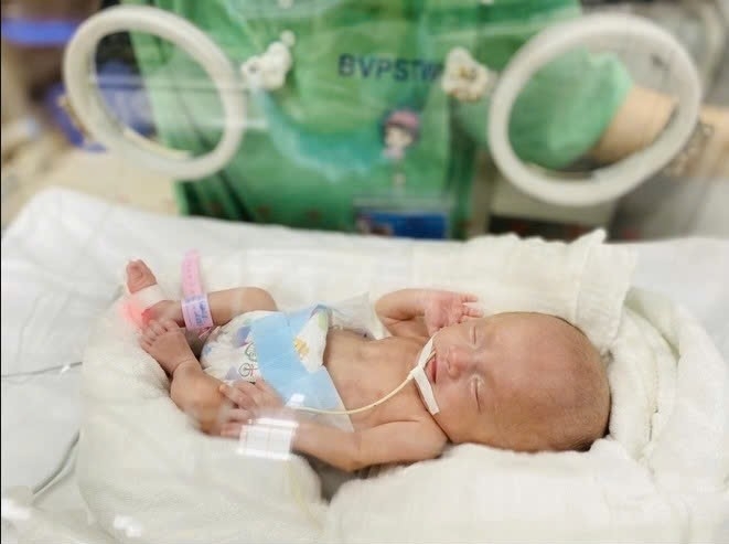 1000025809-1752841346-9320-1752841405 GS Nguyễn Duy Ánh, Giám đốc Bệnh viện Phụ sản Trung ương, phát biểu tại buổi lễ. Ảnh: Mai Hương