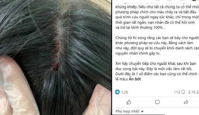 7b66d6d0-a85f-43c1-ba00-d1e408-4754-4771-1753764228 Nhiều thông tin về chích máu chữa đột quỵ được đăng công khai. Ảnh: Ảnh chụp màn hình