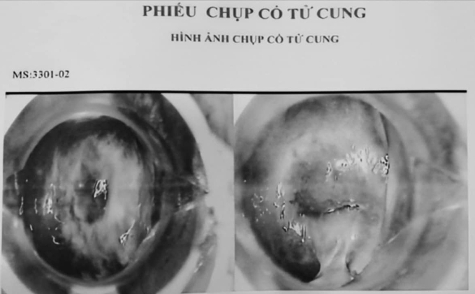 d590c76a-fc59-438b-a549-d8f193-7102-7811-1753318914 Hàng trăm hình ảnh chụp cổ tử cung bệnh lý, có mã số (ký hiệu MS) có sẵn trong máy tính của bác sĩ tại phòng khám. Ảnh: Sở Y tế TP HCM