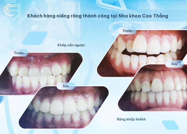 photo-1752469170569-17524691706581617678813 Nha khoa Cao Thắng - Ảnh 4.