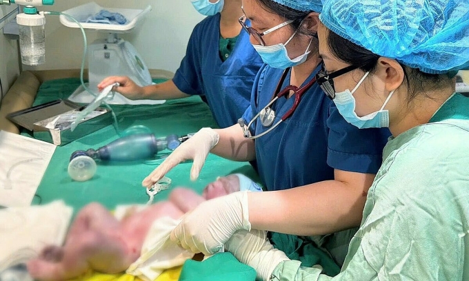 3-1755228303-1755228336-5394-1-5986-3179-1755230608 Em bé chào đời khoẻ mạnh. Ảnh: Bệnh viện cung cấp